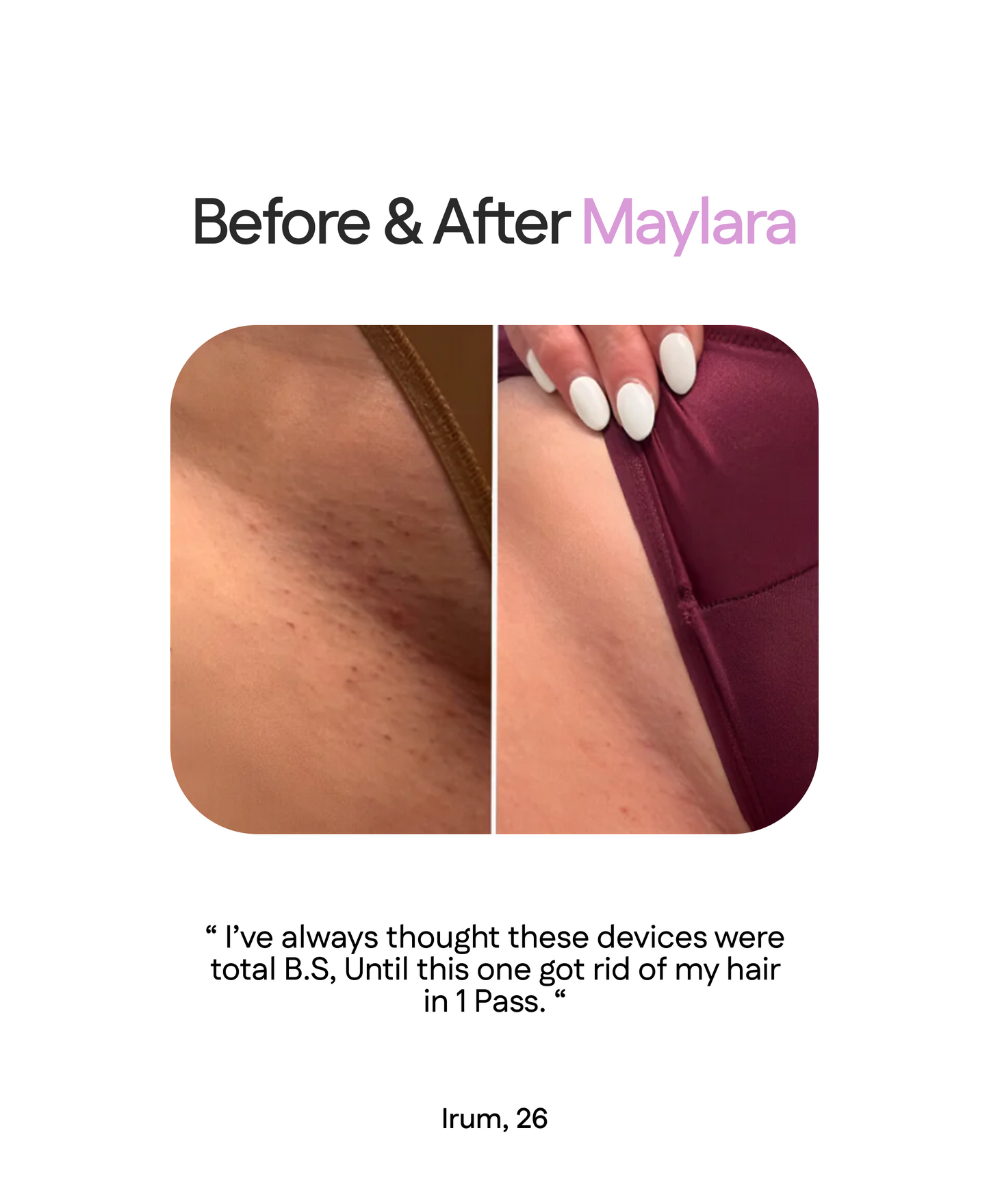 Dual Head Flawless Hair Remover