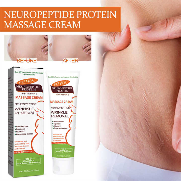 Anti Stretch Mark Removal Cream