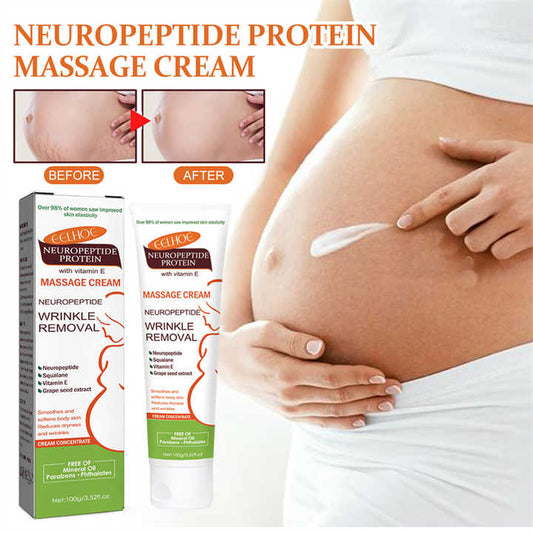 Anti Stretch Mark Removal Cream
